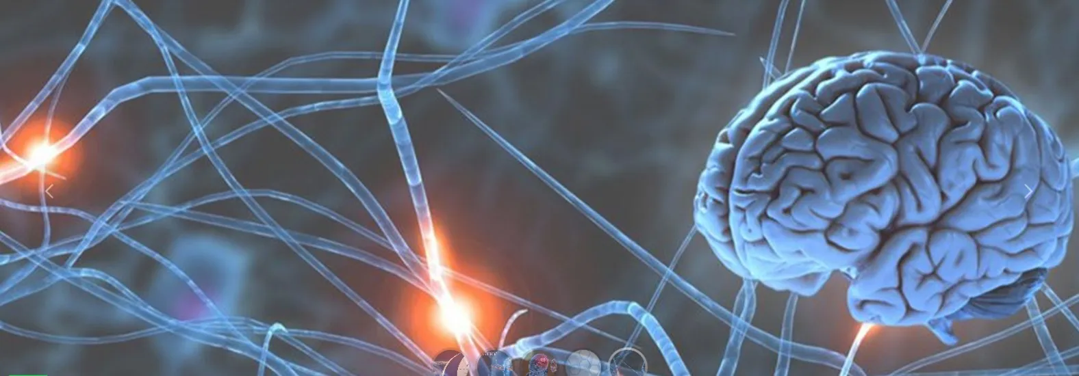 Brain Condition image 1