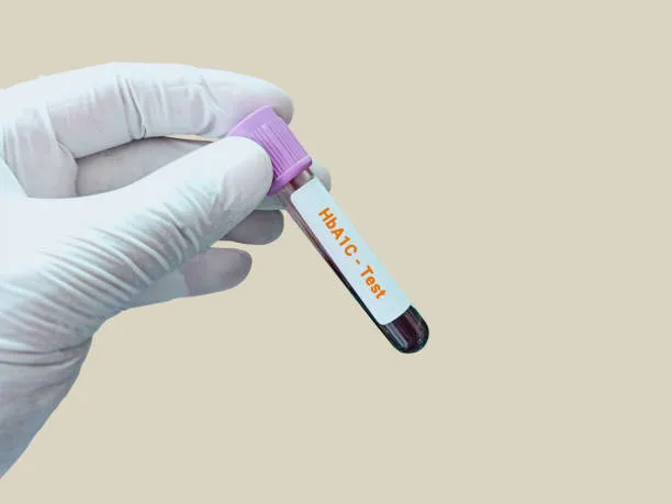 HbA1c image 1