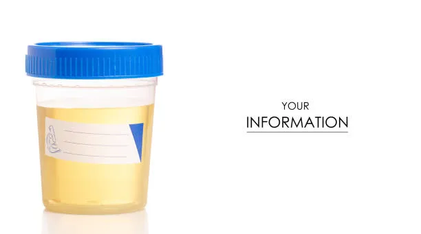 URINE-RM image 1