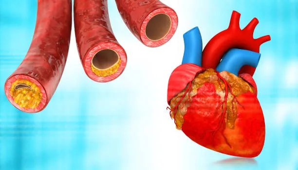 CHOLESTEROL image 1