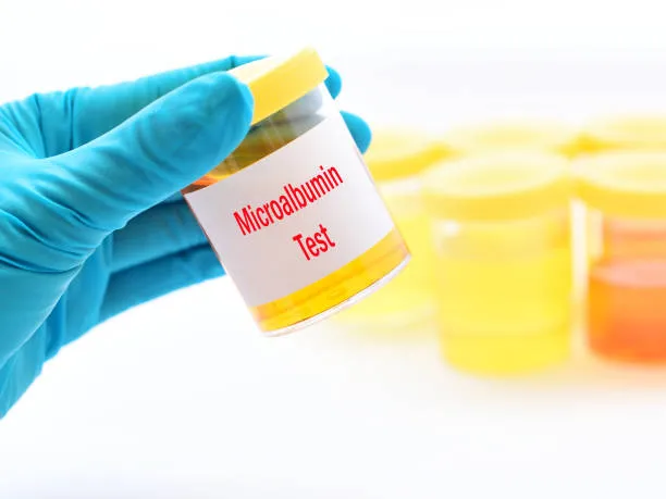 URINE MICROALBUMIN image 1