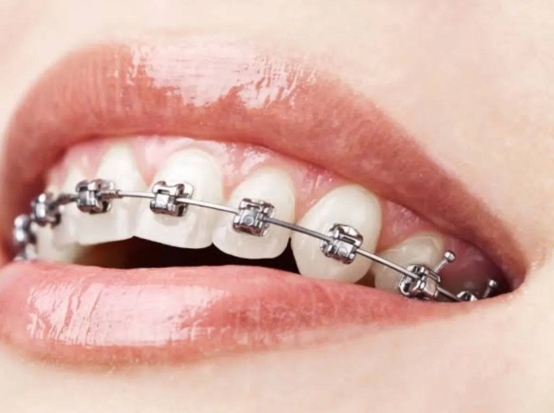  Orthodontic Treatments image 1