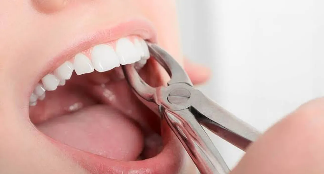 Oral Surgery  Treatments image 1
