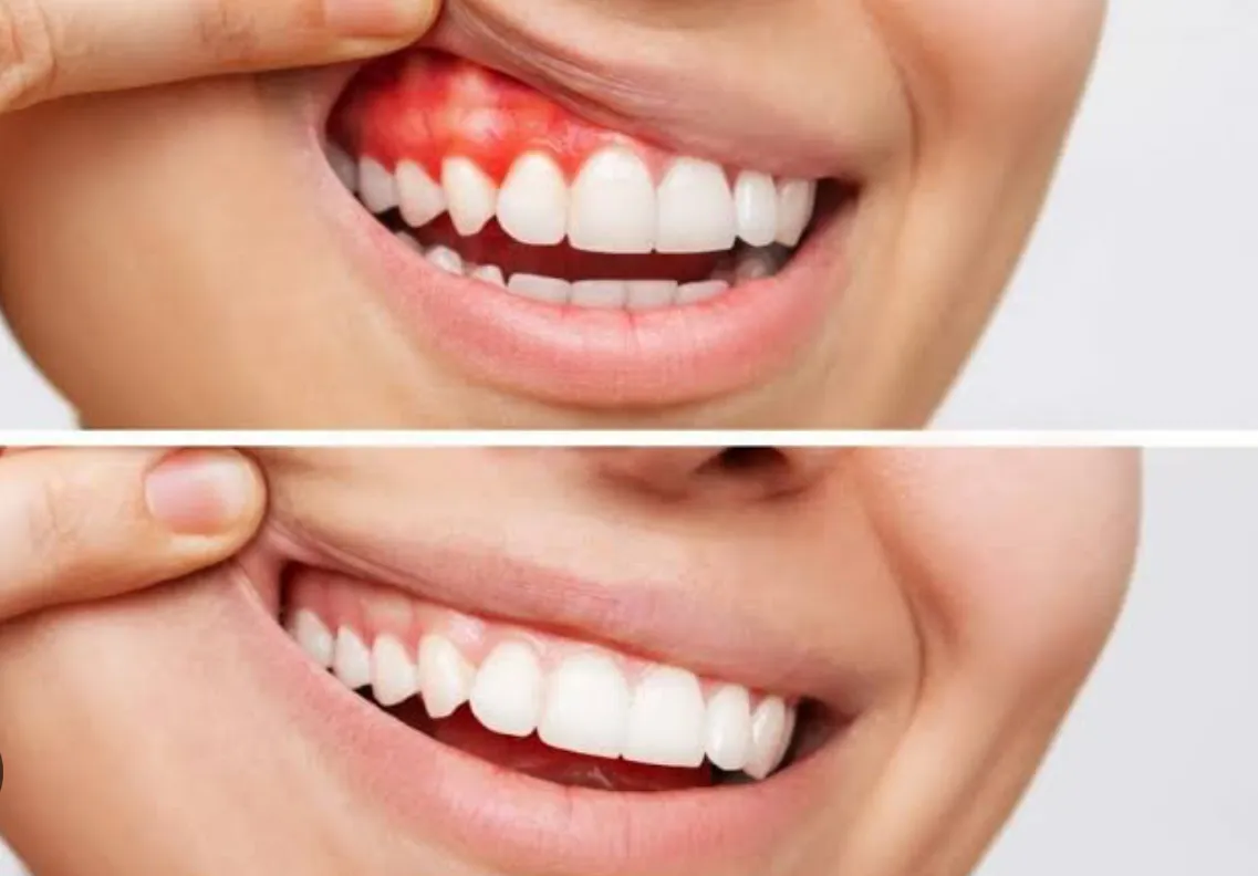  Periodontal Treatment Plan image 1
