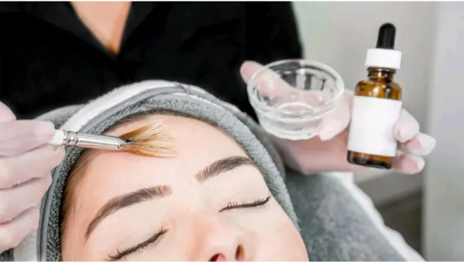 Chemical Peels image 1