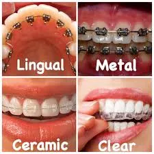 Orthodontic Treatment image 1