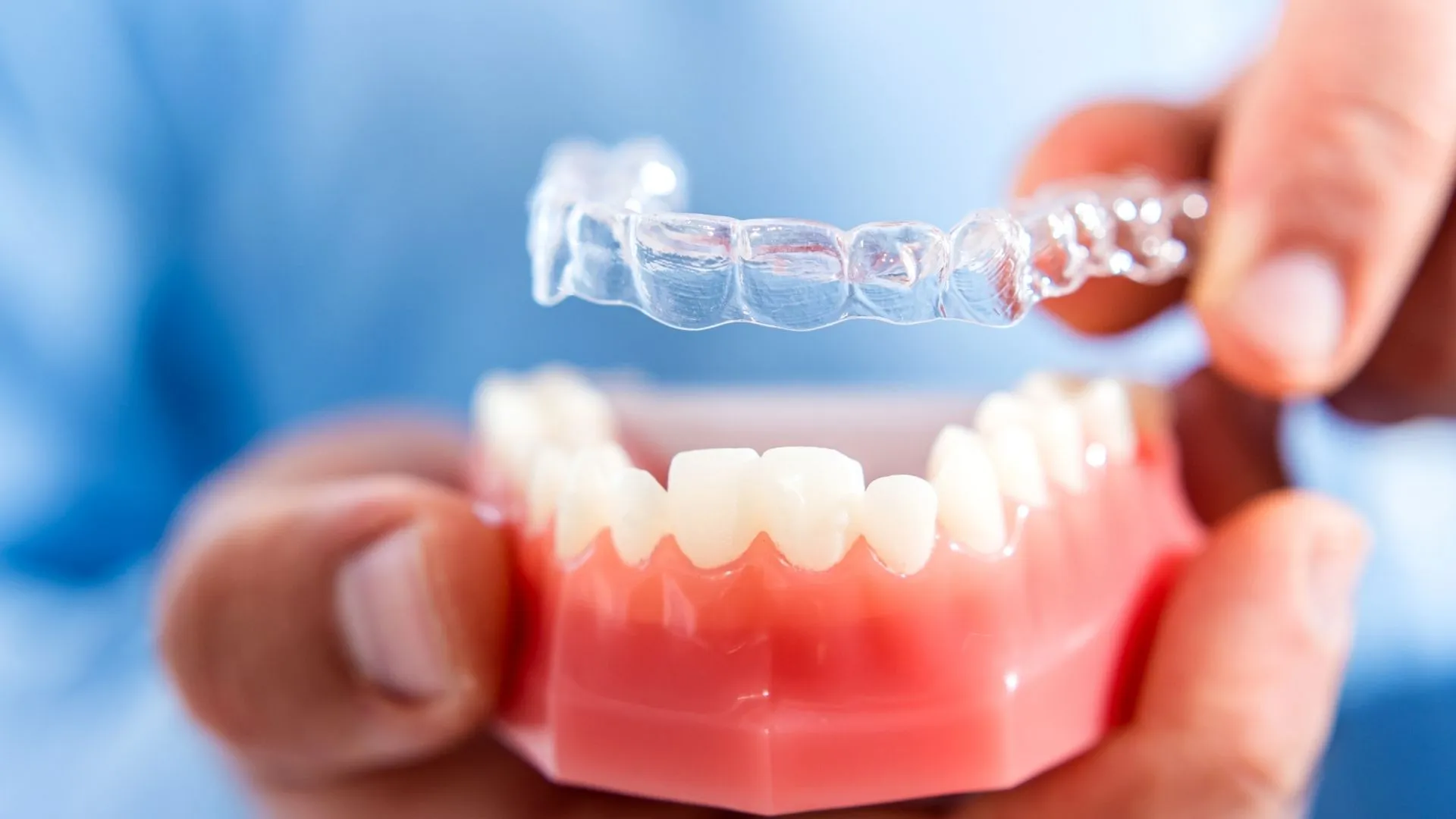 Invisible and Clear Aligners Treatment image 1