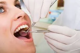 Dental Checkup image 1