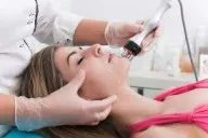 Laser Acne Treatment image 1