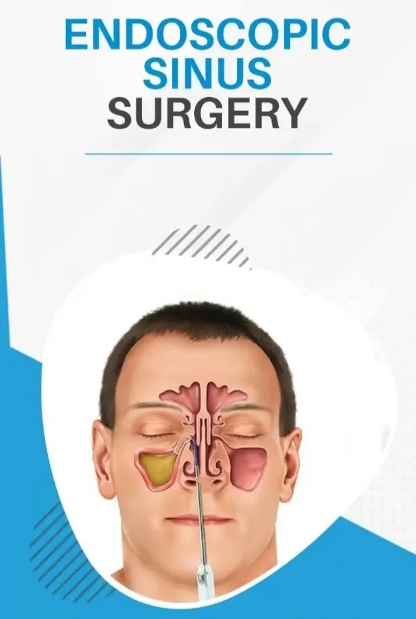 Endoscopic Sinus Surgery image 1