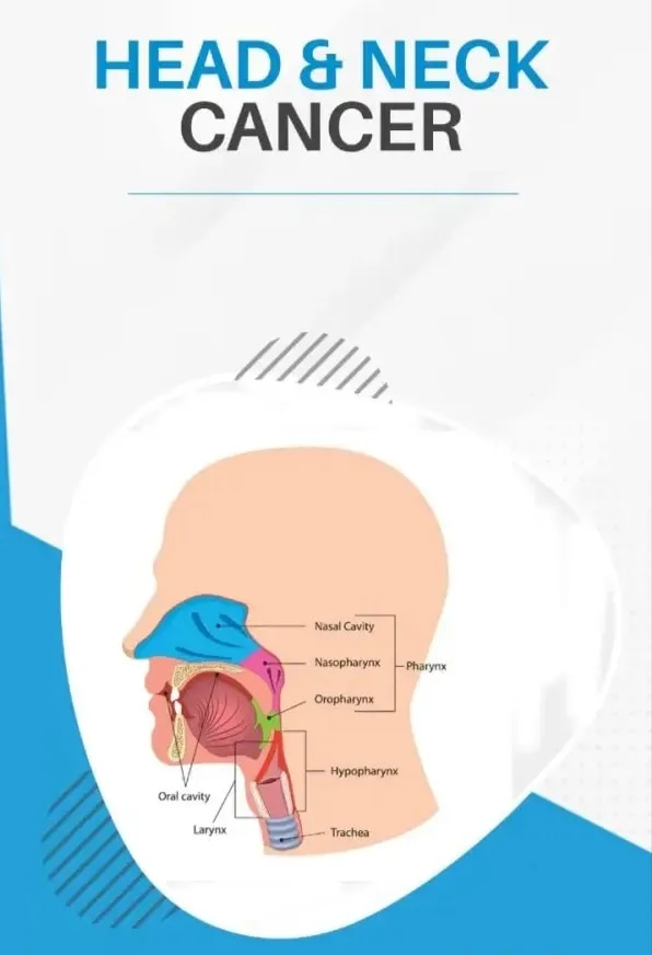 Head and Neck Cancer image 1