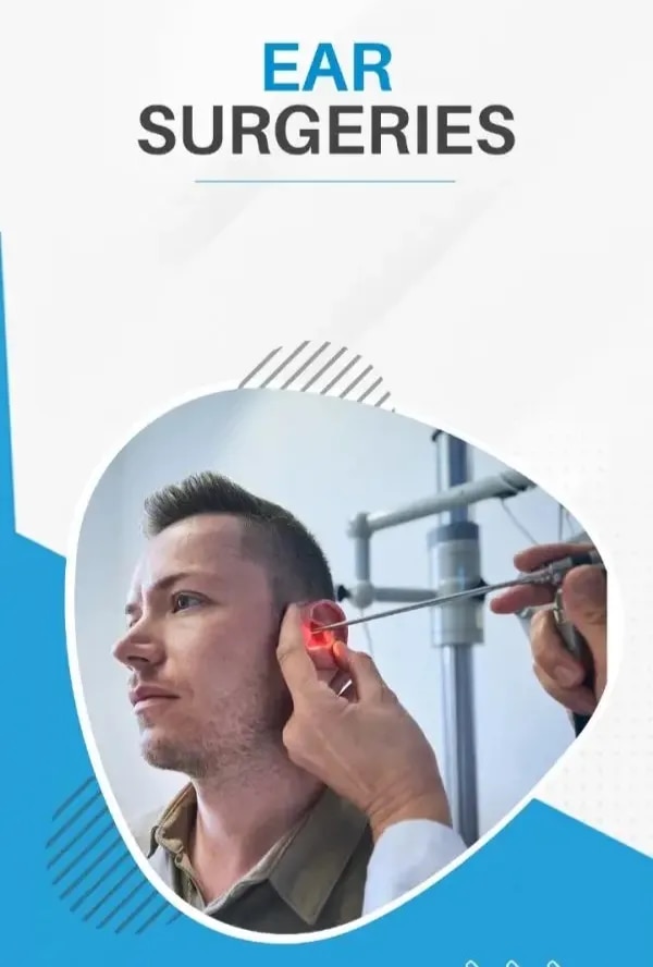 Ear Surgeries image 1