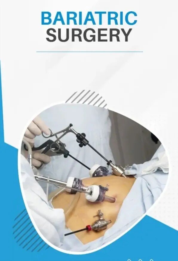 Bariatric Surgery image 1