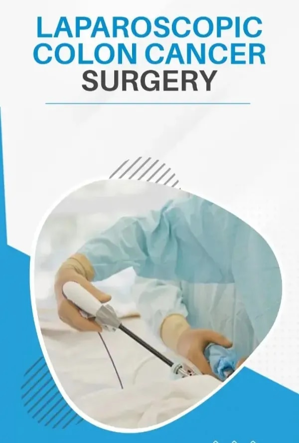 Surgery For Gerd (Gastroesophageal Reflux Disease) image 1
