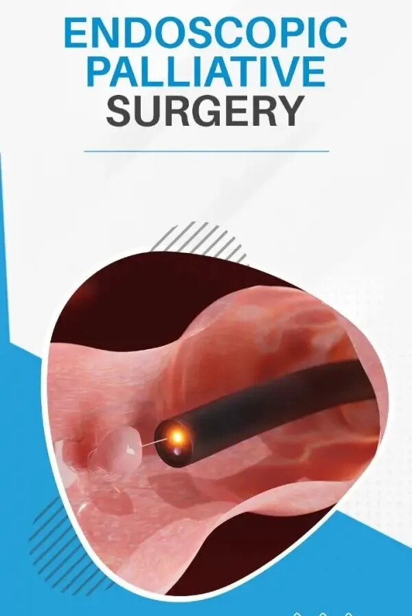 Endoscopic Palliative Surgery image 1