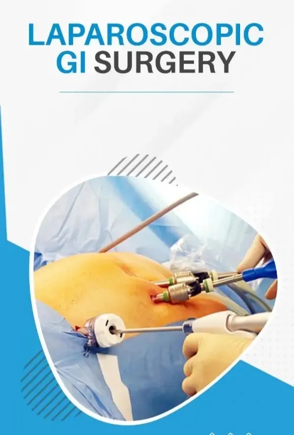 Laparoscopic GI Surgery image 1