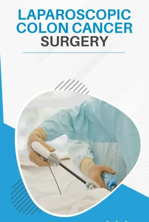 Laparoscopic Colon Cancer Surgery image 1