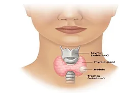 Thyroid image 1