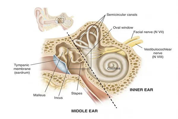Stapedectomy image 1