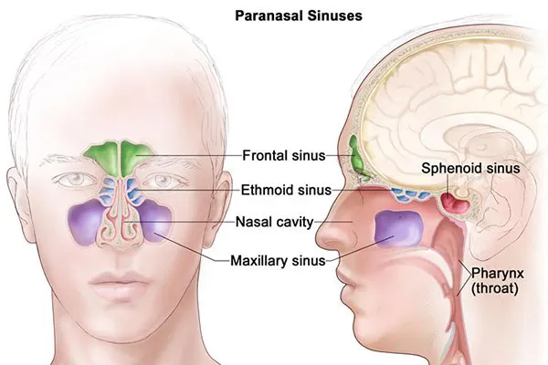 Sinus Surgery image 1