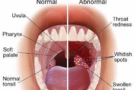 Voice Surgery image 1