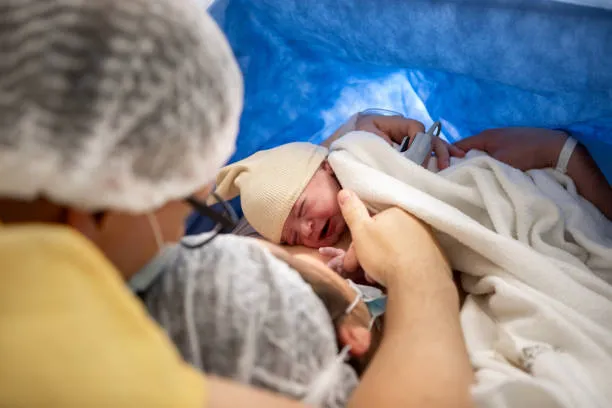 Caesarean Section (C Section) image 1