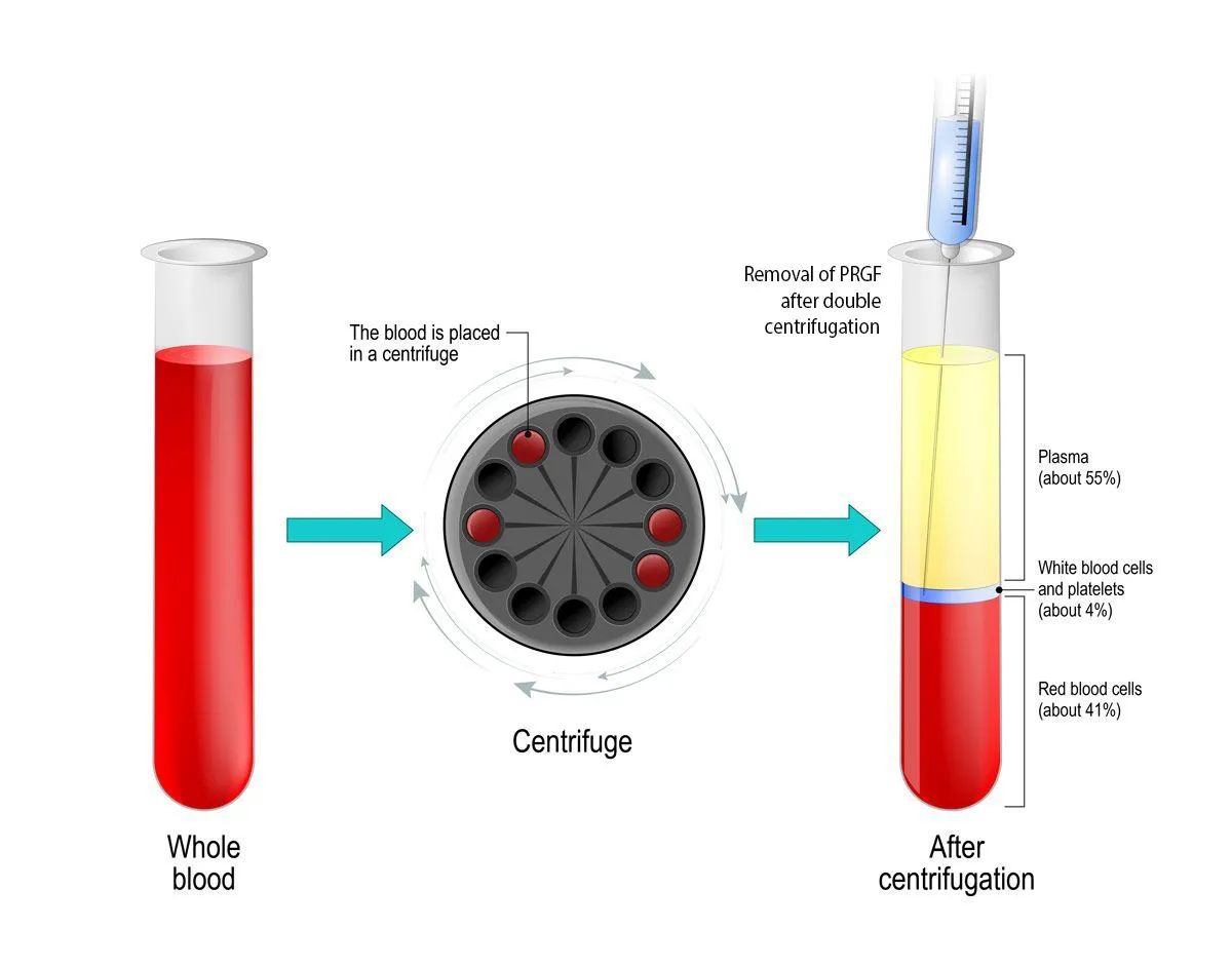 Growth Factor PRP image 1