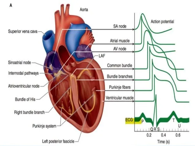 Electrophysiology Studies ( EP Studies ) image 1