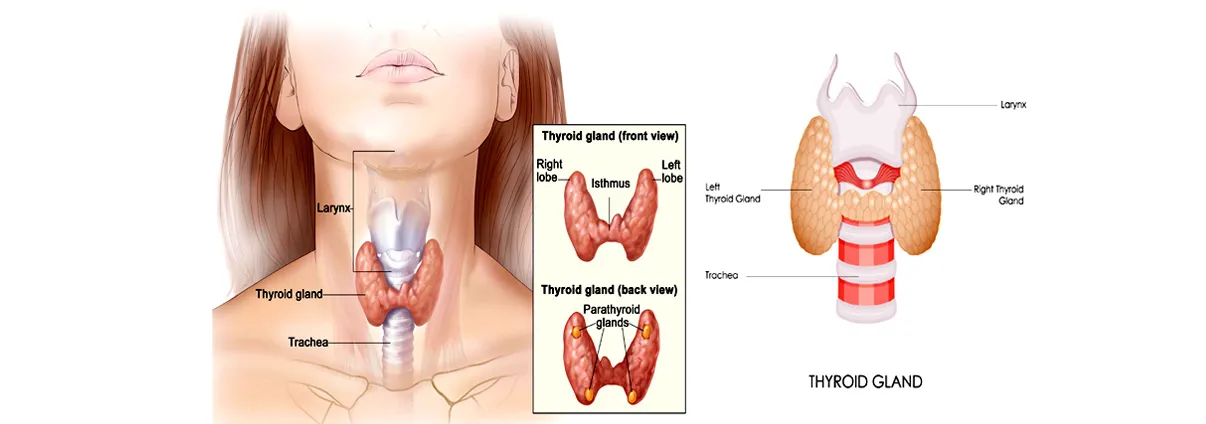 Thyroid surgery image 1