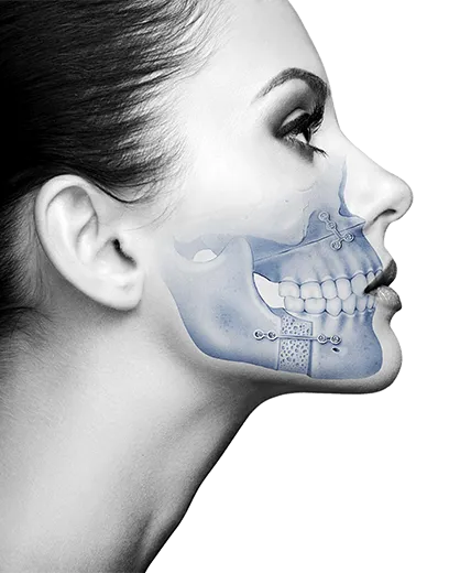 Cosmetic Voice Surgery (Classical Approach) image 1