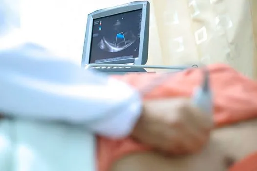 2D Echo,TMT Stress Test Hospital in PCMC,Pune image 1
