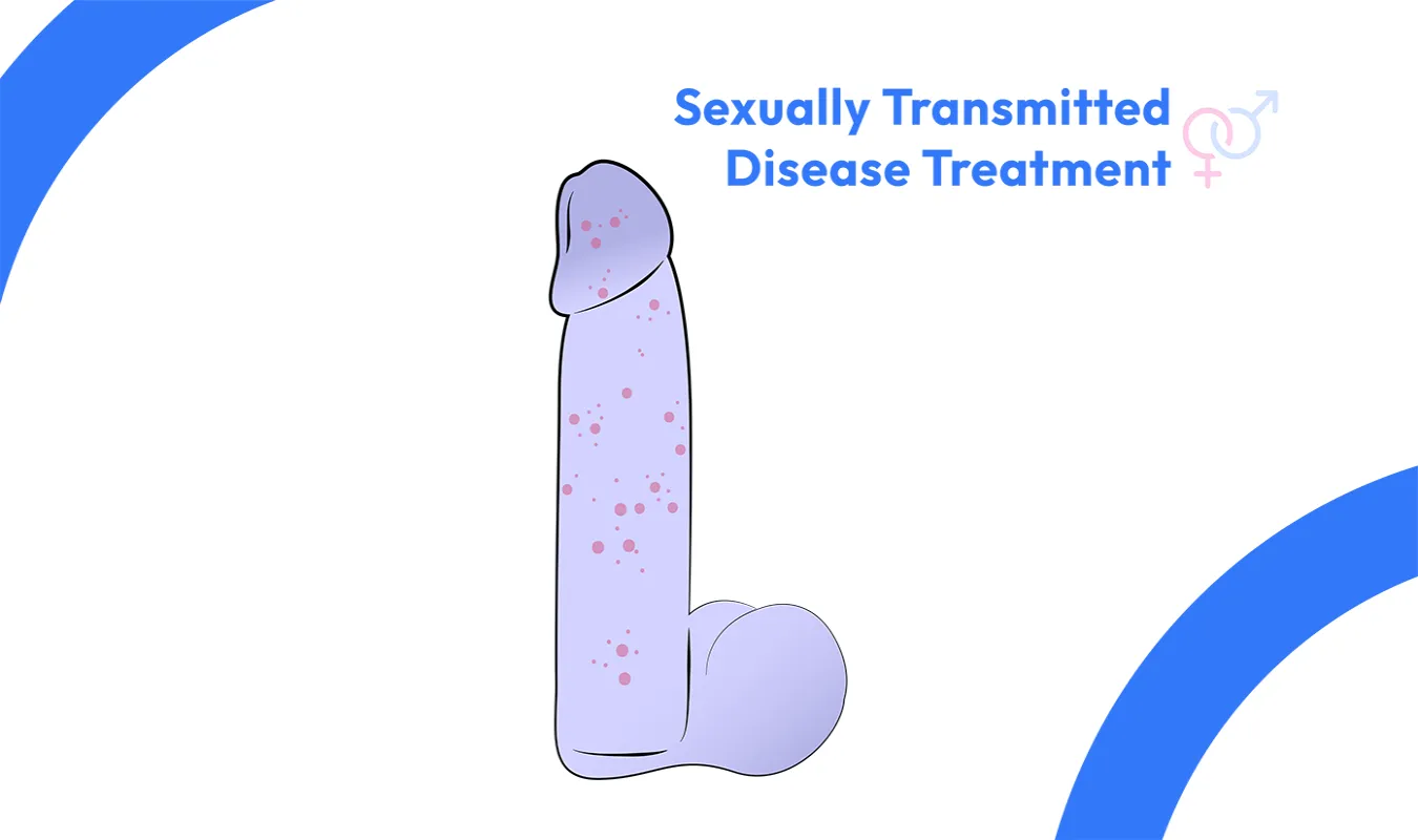 Sexually Transmitted Disease (STDs) image 1