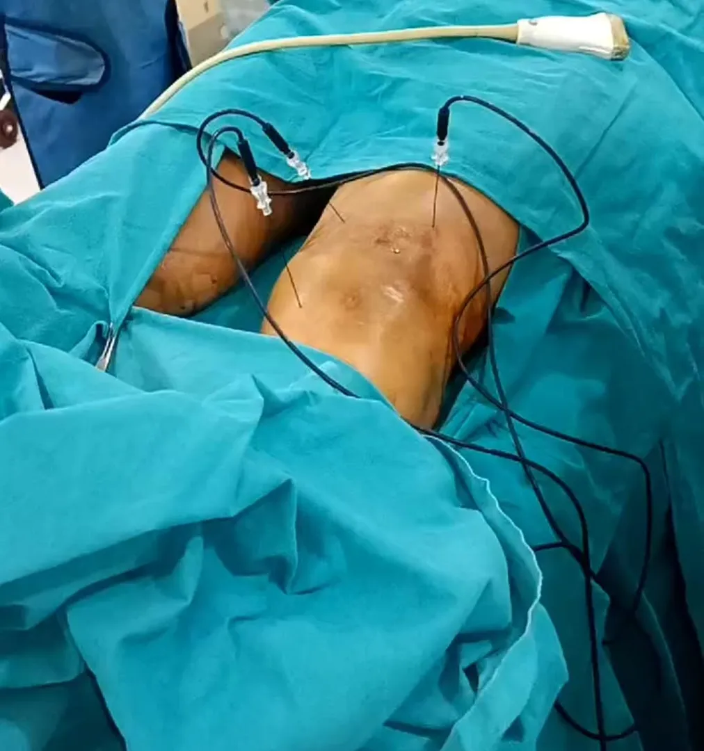 Best Knee Pain Specialist in Pune  image 1