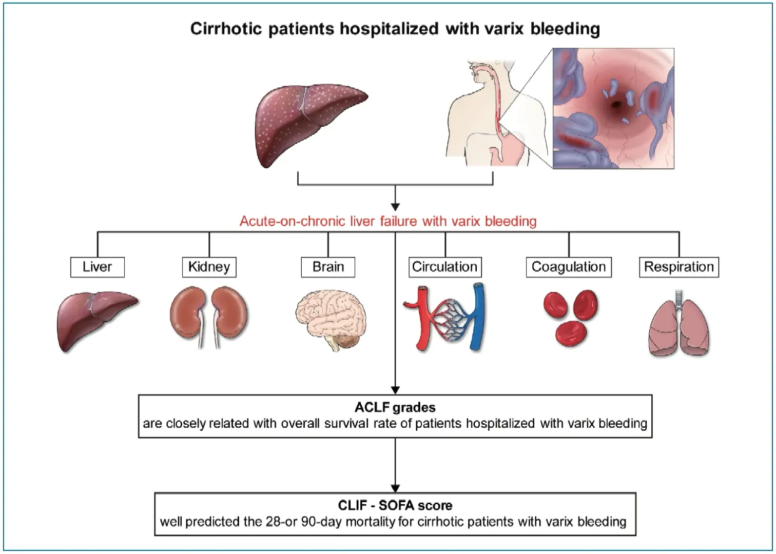ACLF:- Acute chronic liver failure image 1