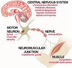 Neuromuscular Disorders image 1
