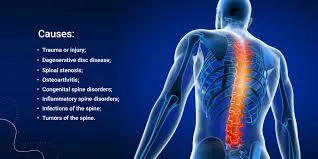 Spinal Disorders image 1