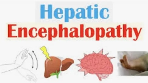 Hepatic Encephalopathy Treatment | Early Diagnosis & Management in Mumbai and India image 1