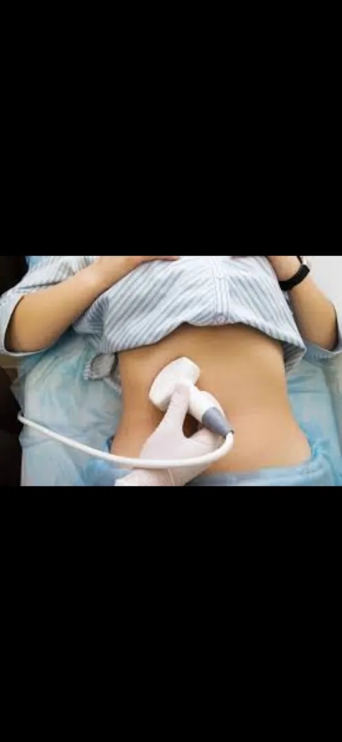 Bowel Ultrasound (IUS) image 1