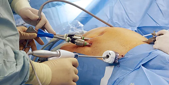 Laparoscopy and Hysteroscopy image 1