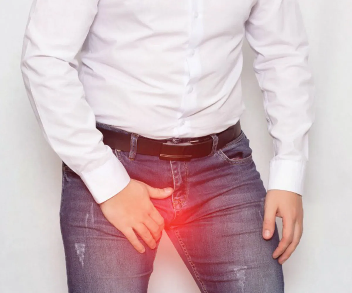 Varicocele Treatment image 1