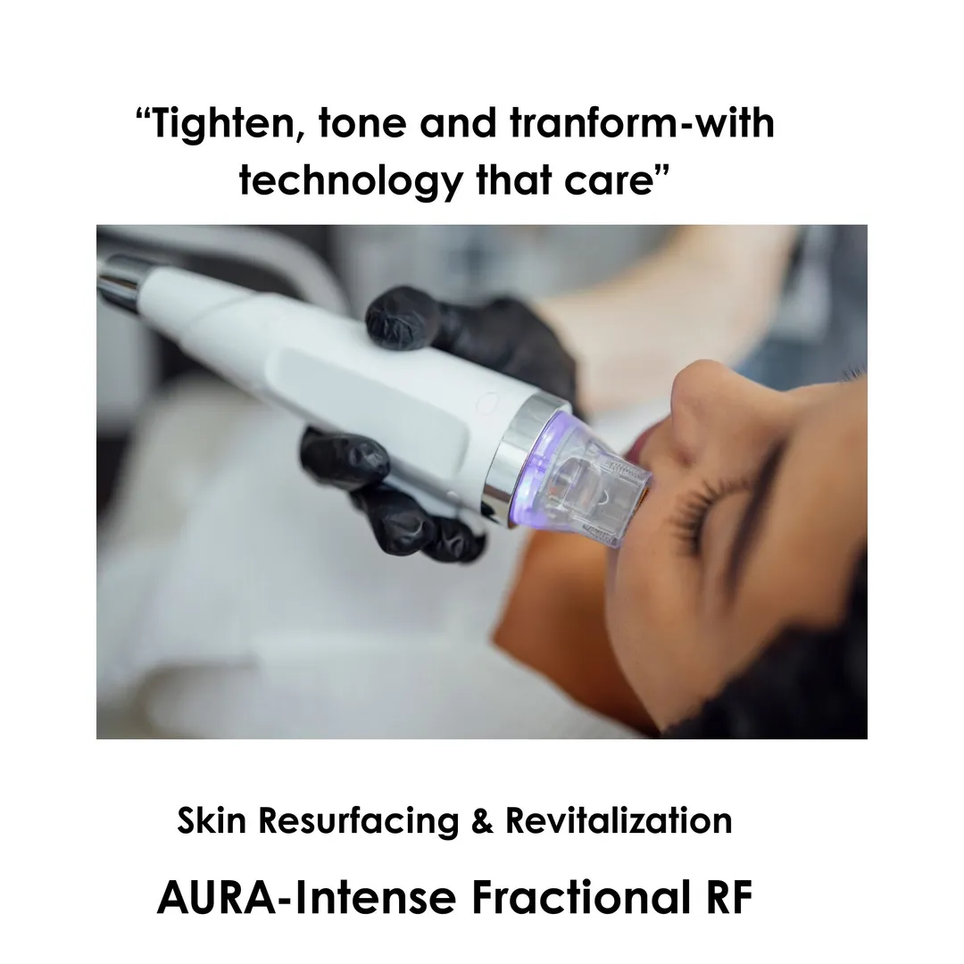 Fractional RF-AURA image 1