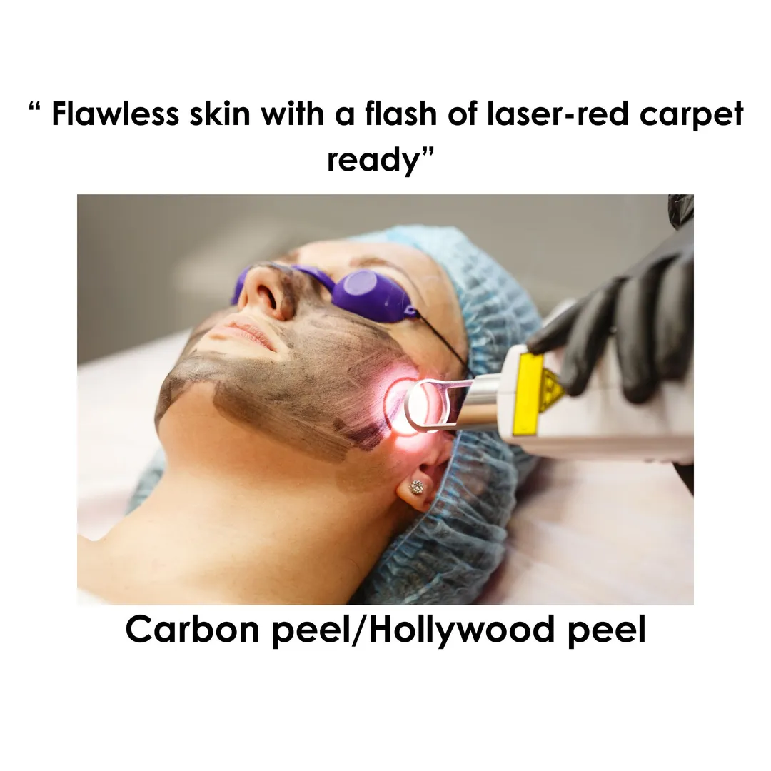 Carboon peel/ Hollywood pell image 1