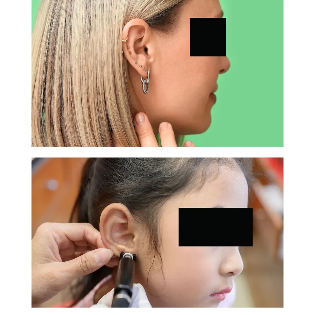 EAR PIERCING image 1