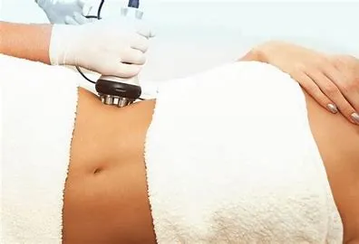 BODY CONTOURING image 2