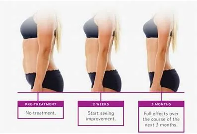 BODY CONTOURING image 4