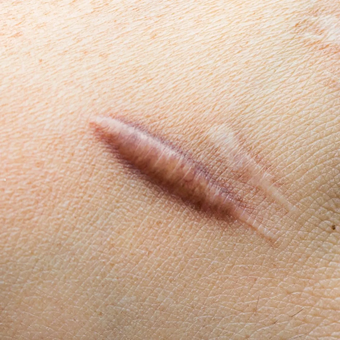 SCAR REVISION image 3