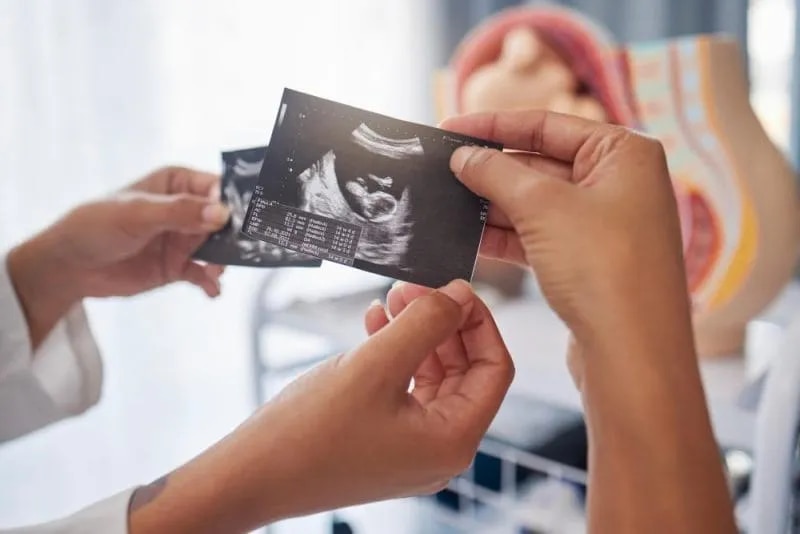 Ultrasonography image 1