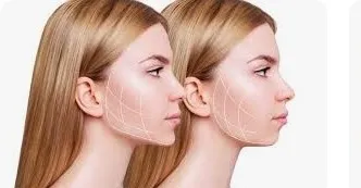 Jawline Correction Clinic in Coimbatore  image 1