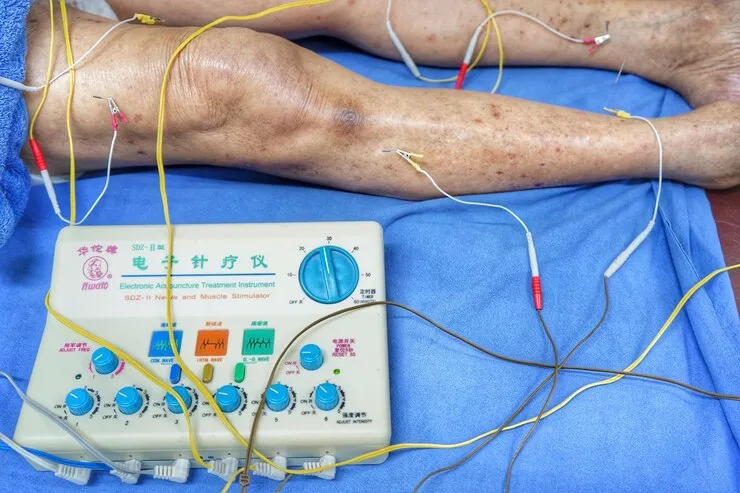 Nerve Conduction Studies (NCS) image 1