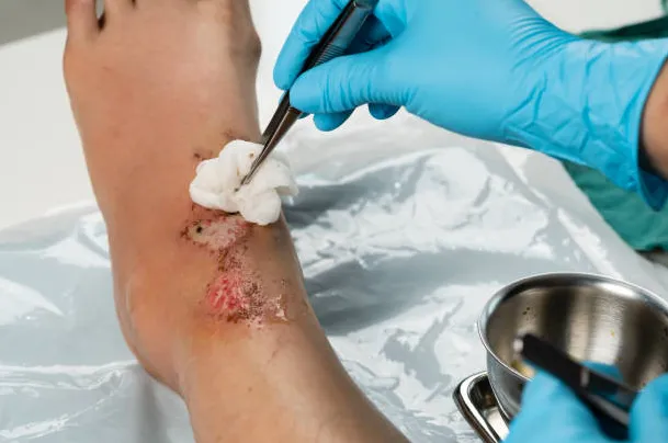 Scar Treatment image 1